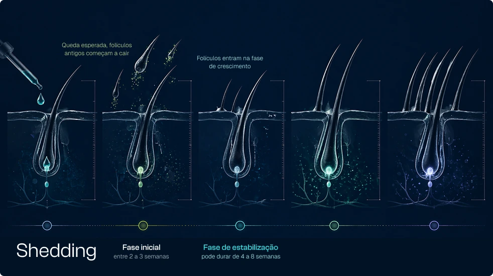 Shedding Inicial: Por que seu cabelo pode cair mais no início do tratamento?